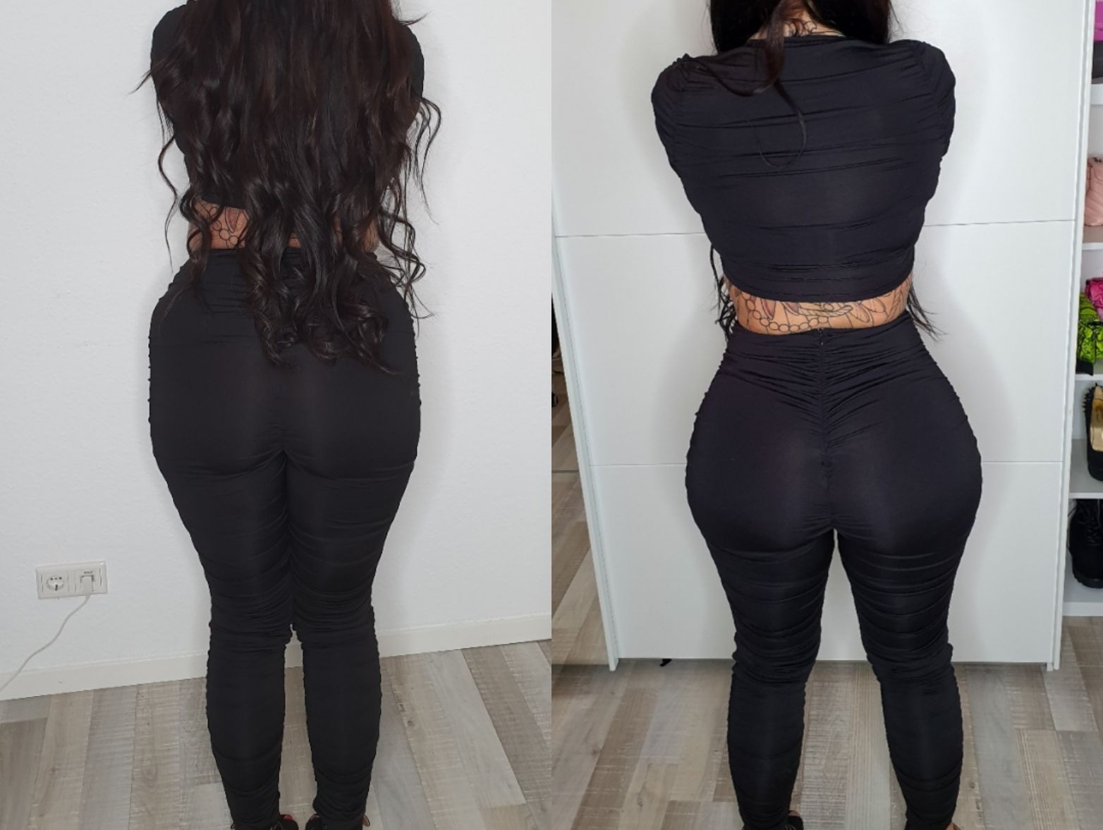 Patient Story Brazilian Butt Lift Before and After
