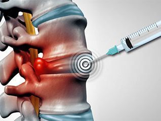 An image showcasing the Back Pain Treatment package, provided by Pain Management NYC (Bronx) An image showcasing the Back Pain Treatment package, provided by Pain Management NYC (Bronx)