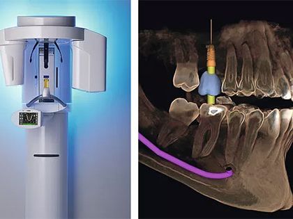 An image showcasing the Dentistry / Stomatology package, provided by LuxDen Dental Center An image showcasing the Dentistry / Stomatology package, provided by LuxDen Dental Center