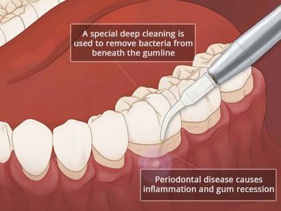 An image showcasing the Dentistry / Stomatology package, provided by LuxDen Dental Center An image showcasing the Dentistry / Stomatology package, provided by LuxDen Dental Center