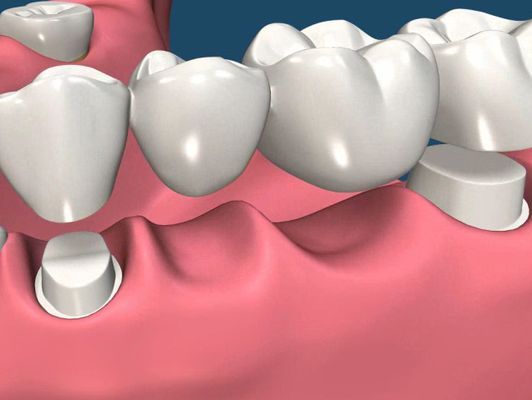 An image showcasing the Dentistry / Stomatology package, provided by Park Avenue Smiles An image showcasing the Dentistry / Stomatology package, provided by Park Avenue Smiles
