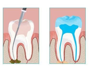 An image showcasing the Dentistry / Stomatology package, provided by LuxDen Dental Center An image showcasing the Dentistry / Stomatology package, provided by LuxDen Dental Center
