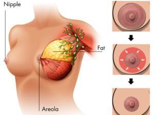 An image showcasing the Plastic Surgery or Cosmetic Surgery package, provided by Rowe Plastic Surgery An image showcasing the Plastic Surgery or Cosmetic Surgery package, provided by Rowe Plastic Surgery