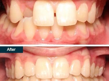 An image showcasing the Orthodontics package, provided by Park Avenue Smiles An image showcasing the Orthodontics package, provided by Park Avenue Smiles