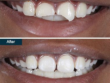 An image showcasing the Dentistry / Stomatology package, provided by Family Cosmetic & Implant Dentistry of Brooklyn An image showcasing the Dentistry / Stomatology package, provided by Family Cosmetic & Implant Dentistry of Brooklyn