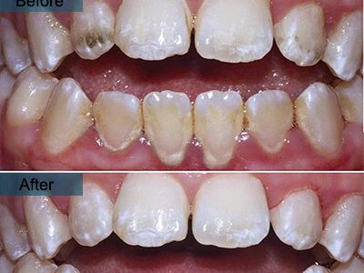 An image showcasing the Dentistry / Stomatology package, provided by Family Cosmetic & Implant Dentistry of Brooklyn An image showcasing the Dentistry / Stomatology package, provided by Family Cosmetic & Implant Dentistry of Brooklyn