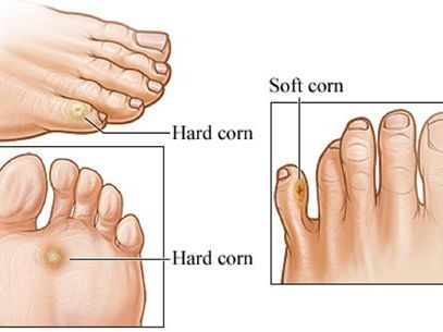 An image showcasing the Podiatry package, provided by Manhattan Foot Specialists An image showcasing the Podiatry package, provided by Manhattan Foot Specialists