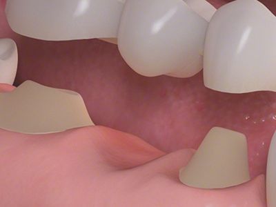 An image showcasing the Dentistry / Stomatology package, provided by 505 Dental Associates An image showcasing the Dentistry / Stomatology package, provided by 505 Dental Associates
