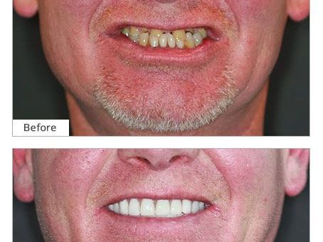 An image showcasing the Dentistry / Stomatology package, provided by Broadway Family Dental An image showcasing the Dentistry / Stomatology package, provided by Broadway Family Dental