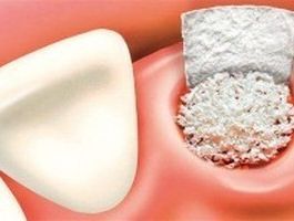 An image showcasing the Dentistry / Stomatology package, provided by Manhattan Periodontics & Implant Dentistry An image showcasing the Dentistry / Stomatology package, provided by Manhattan Periodontics & Implant Dentistry