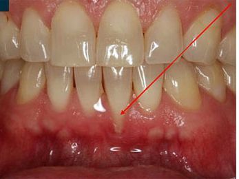 An image showcasing the Dentistry / Stomatology package, provided by Manhattan Periodontics & Implant Dentistry An image showcasing the Dentistry / Stomatology package, provided by Manhattan Periodontics & Implant Dentistry