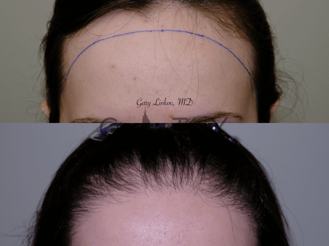 An image showcasing the Hair Restoration and Transplantation package, provided by City Facial Plastics An image showcasing the Hair Restoration and Transplantation package, provided by City Facial Plastics