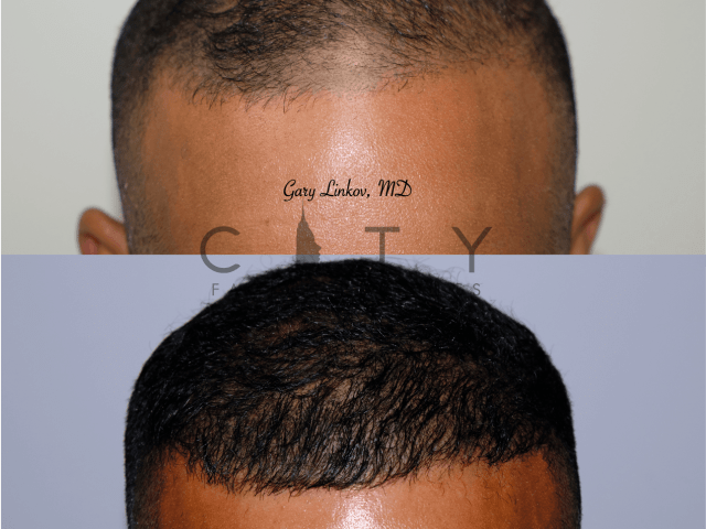 An image showcasing the Plastic Surgery or Cosmetic Surgery package, provided by City Facial Plastics An image showcasing the Plastic Surgery or Cosmetic Surgery package, provided by City Facial Plastics