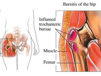 An image showcasing the Sports Medicine package, provided by Sports Injury & Pain Management Clinic of New York An image showcasing the Sports Medicine package, provided by Sports Injury & Pain Management Clinic of New York