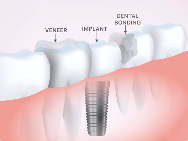 An image showcasing the Dentistry / Stomatology package, provided by LuxDen Dental Center An image showcasing the Dentistry / Stomatology package, provided by LuxDen Dental Center
