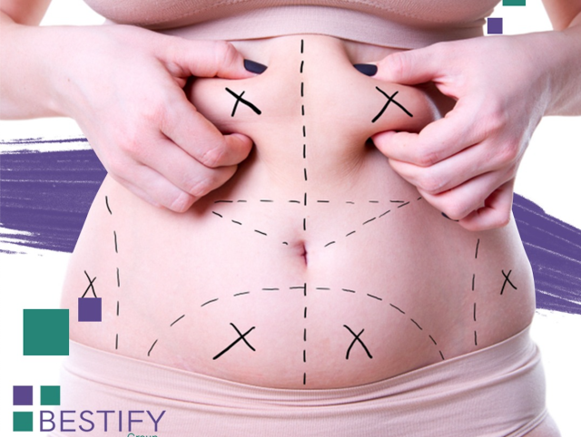 Liposuction Turkey Liposuction Turkey
