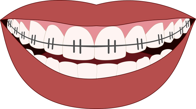 Orthodontics Orthodontics