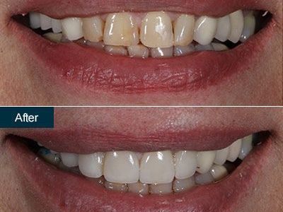 An image showcasing the Dentistry / Stomatology package, provided by Family Cosmetic & Implant Dentistry of Brooklyn An image showcasing the Dentistry / Stomatology package, provided by Family Cosmetic & Implant Dentistry of Brooklyn