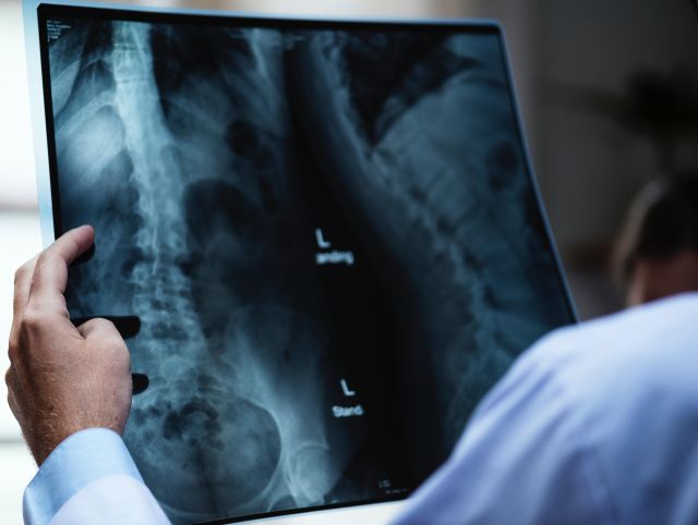 Spine Care Treatments and Surgery Services Spine Care and Surgery Services