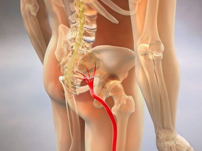 An image showcasing the Pain Management package, provided by Pain Management NYC (Bronx) An image showcasing the Pain Management package, provided by Pain Management NYC (Bronx)