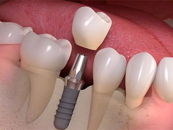 An image showcasing the Dentistry / Stomatology package, provided by 505 Dental Associates An image showcasing the Dentistry / Stomatology package, provided by 505 Dental Associates