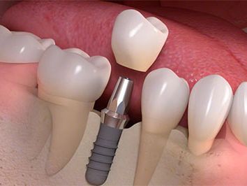 An image showcasing the Dentistry / Stomatology package, provided by Park Avenue Smiles An image showcasing the Dentistry / Stomatology package, provided by Park Avenue Smiles