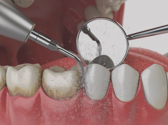 An image showcasing the Cosmetic Dentistry package, provided by Stamford Dental Arts An image showcasing the Cosmetic Dentistry package, provided by Stamford Dental Arts