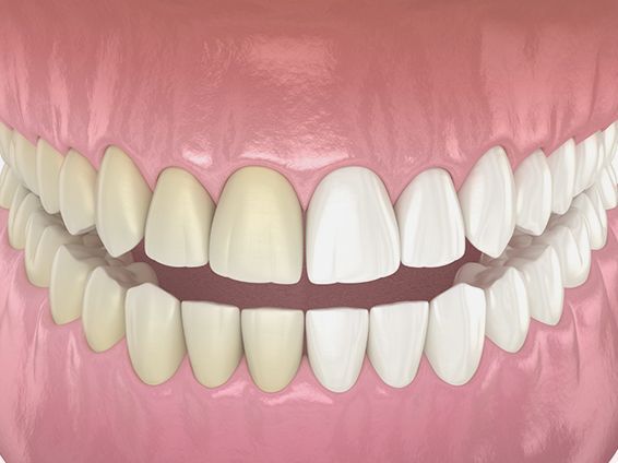 An image showcasing the Cosmetic Dentistry package, provided by Stamford Dental Arts An image showcasing the Cosmetic Dentistry package, provided by Stamford Dental Arts