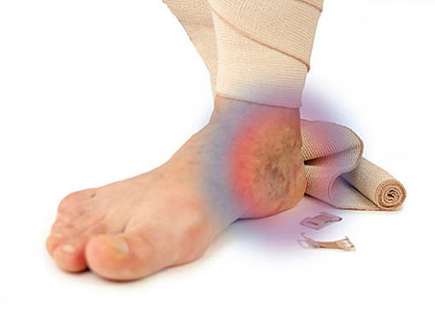 An image showcasing the Vascular Medicine package, provided by Varicose Vein Treatments Center An image showcasing the Vascular Medicine package, provided by Varicose Vein Treatments Center