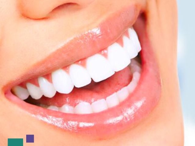 Veneers Turkey Veneers Turkey