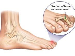 An image showcasing the Podiatry package, provided by Premier Podiatry An image showcasing the Podiatry package, provided by Premier Podiatry