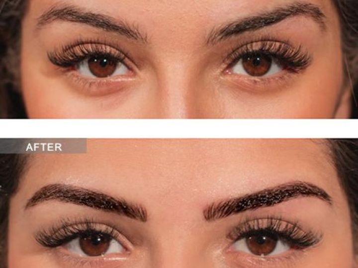 Wellness Package Microblading Eyebrows NYC Best Aesthetic Specialist